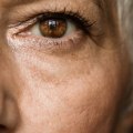What Activities Should You Avoid After Cataract Surgery?