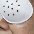 How soon after cataract surgery can i bend over?