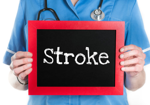 Can Cataract Surgery Cause a Stroke?