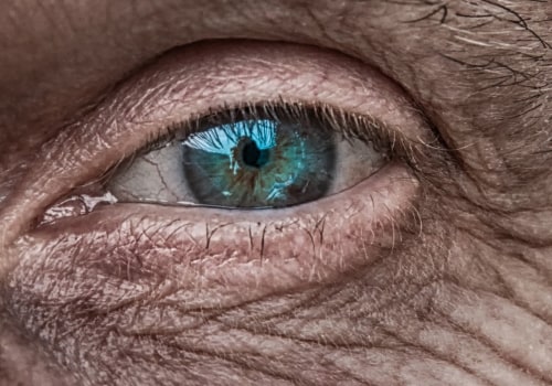 Which Cataract Surgery is Better: Traditional or Laser?