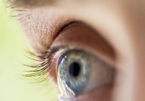 How Long Does it Take for Vision to Stabilize After Cataract Surgery?
