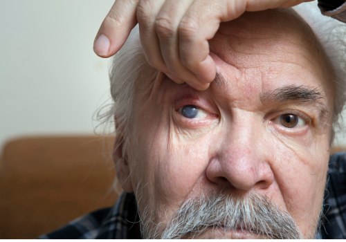 Is Cataract Surgery Painful? An Expert's Perspective