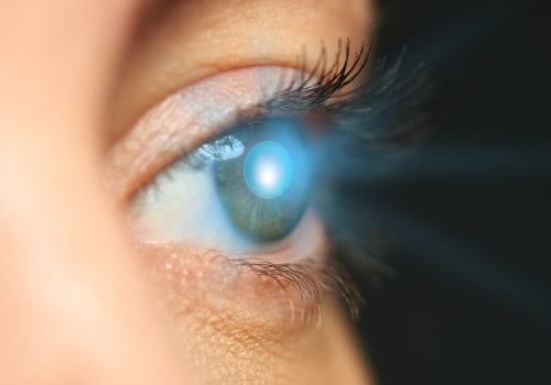 How Long Does Vision Continue to Improve After Cataract Surgery?