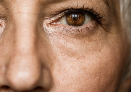 Can you lift and bend after cataract surgery?